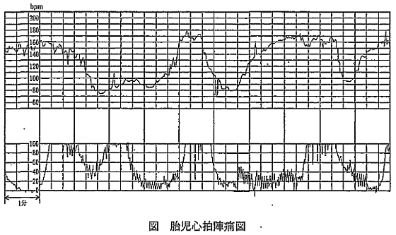 問35の画像