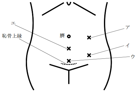 問36の画像